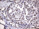 DDX56 Antibody in Immunohistochemistry (Paraffin) (IHC (P))