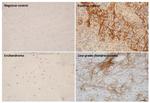 Periostin Antibody in Immunohistochemistry (Paraffin) (IHC (P))