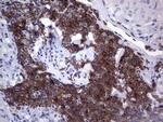 TFPI2 Antibody in Immunohistochemistry (Paraffin) (IHC (P))