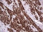 MB67 Antibody in Immunohistochemistry (Paraffin) (IHC (P))