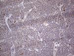 MB67 Antibody in Immunohistochemistry (Paraffin) (IHC (P))