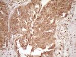 GFI1 Antibody in Immunohistochemistry (Paraffin) (IHC (P))