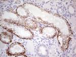 PRKD3 Antibody in Immunohistochemistry (Paraffin) (IHC (P))