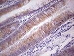 PRKD3 Antibody in Immunohistochemistry (Paraffin) (IHC (P))