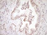 LPIN1 Antibody in Immunohistochemistry (Paraffin) (IHC (P))