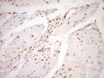 LPIN1 Antibody in Immunohistochemistry (Paraffin) (IHC (P))