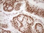 LPIN1 Antibody in Immunohistochemistry (Paraffin) (IHC (P))