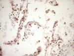 LPIN1 Antibody in Immunohistochemistry (Paraffin) (IHC (P))