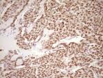 LPIN1 Antibody in Immunohistochemistry (Paraffin) (IHC (P))