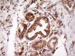 LRRC6 Antibody in Immunohistochemistry (Paraffin) (IHC (P))