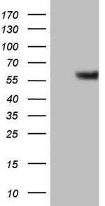 GABRA5 Antibody in Western Blot (WB)