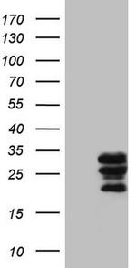 WIBG Antibody in Western Blot (WB)