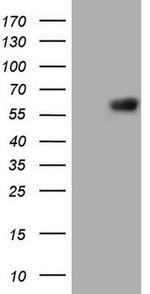Protein Z Antibody in Western Blot (WB)