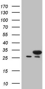 NUDT21 Antibody in Western Blot (WB)