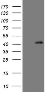 CTGF Antibody in Western Blot (WB)