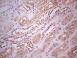 Hairless Antibody in Immunohistochemistry (Paraffin) (IHC (P))