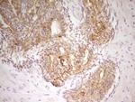 PAK4 Antibody in Immunohistochemistry (Paraffin) (IHC (P))