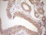 TRIB3 Antibody in Immunohistochemistry (Paraffin) (IHC (P))