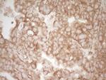 Pellino 1 Antibody in Immunohistochemistry (Paraffin) (IHC (P))