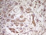 TRIB3 Antibody in Immunohistochemistry (Paraffin) (IHC (P))