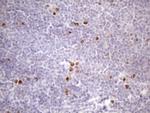 CDCA8 Antibody in Immunohistochemistry (Paraffin) (IHC (P))