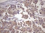 SMCP Antibody in Immunohistochemistry (Paraffin) (IHC (P))