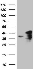 SPT3 Antibody in Western Blot (WB)