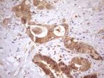 ASB2 Antibody in Immunohistochemistry (Paraffin) (IHC (P))