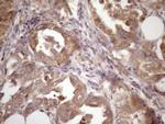 ASB2 Antibody in Immunohistochemistry (Paraffin) (IHC (P))