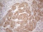 BTG2 Antibody in Immunohistochemistry (Paraffin) (IHC (P))