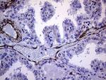 Melanophilin Antibody in Immunohistochemistry (Paraffin) (IHC (P))