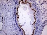 Melanophilin Antibody in Immunohistochemistry (Paraffin) (IHC (P))