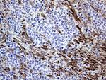 Melanophilin Antibody in Immunohistochemistry (Paraffin) (IHC (P))