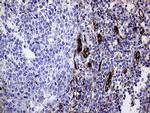 Melanophilin Antibody in Immunohistochemistry (Paraffin) (IHC (P))