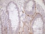 BLNK Antibody in Immunohistochemistry (Paraffin) (IHC (P))