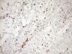 BLNK Antibody in Immunohistochemistry (Paraffin) (IHC (P))