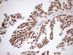 EXOSC1 Antibody in Immunohistochemistry (Paraffin) (IHC (P))