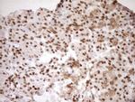 EXOSC1 Antibody in Immunohistochemistry (Paraffin) (IHC (P))