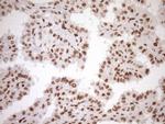 EXOSC1 Antibody in Immunohistochemistry (Paraffin) (IHC (P))