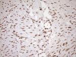 EXOSC1 Antibody in Immunohistochemistry (Paraffin) (IHC (P))