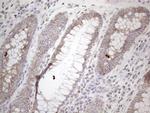 DLX4 Antibody in Immunohistochemistry (Paraffin) (IHC (P))