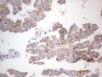 DLX4 Antibody in Immunohistochemistry (Paraffin) (IHC (P))