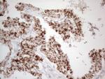 DLX4 Antibody in Immunohistochemistry (Paraffin) (IHC (P))