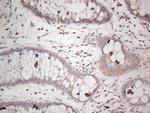 AMTN Antibody in Immunohistochemistry (Paraffin) (IHC (P))