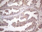 AMTN Antibody in Immunohistochemistry (Paraffin) (IHC (P))