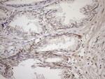 Aladin Antibody in Immunohistochemistry (Paraffin) (IHC (P))