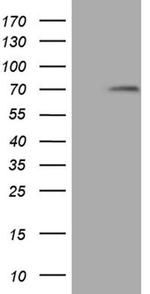 MAK Antibody in Western Blot (WB)