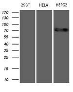 MAK Antibody in Western Blot (WB)