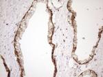 SHMT2 Antibody in Immunohistochemistry (Paraffin) (IHC (P))