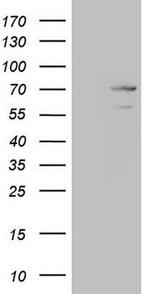 MAK Antibody in Western Blot (WB)